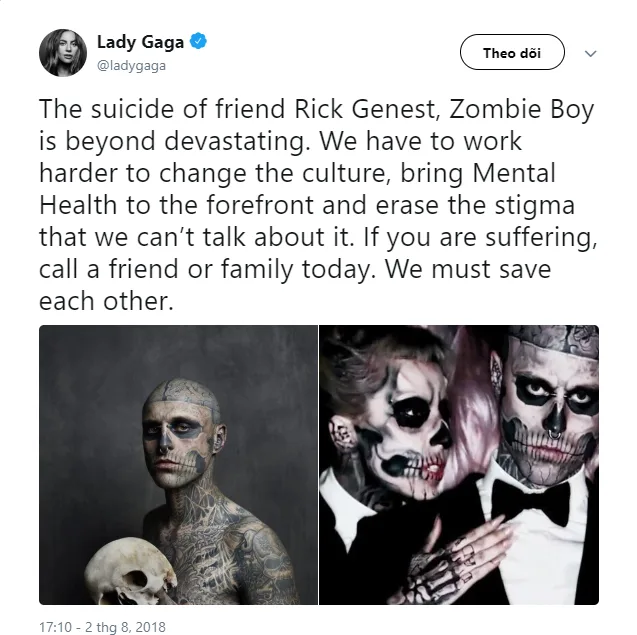 Lady Gaga chia sẻ đầy xúc động về người mẫu Zombie Boy từng hợp tác với cô trong MV "Born This Way". Ảnh: Twitter Lady Gaga