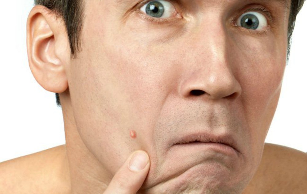 tác hại của stress - elle man 3