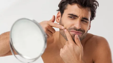 Cách trị mụn trứng cá nhanh nhất Cách trị mụn trứng cá nhanh nhất