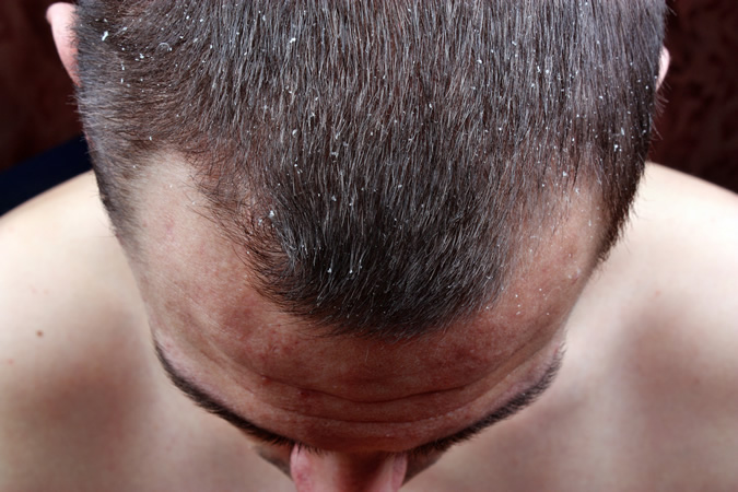 vấn đề cơ thể 13