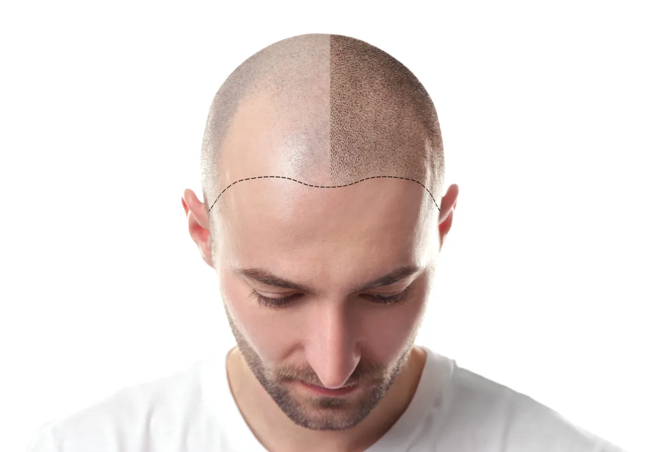 Ảnh: NCS Cosmetic Surgeries
